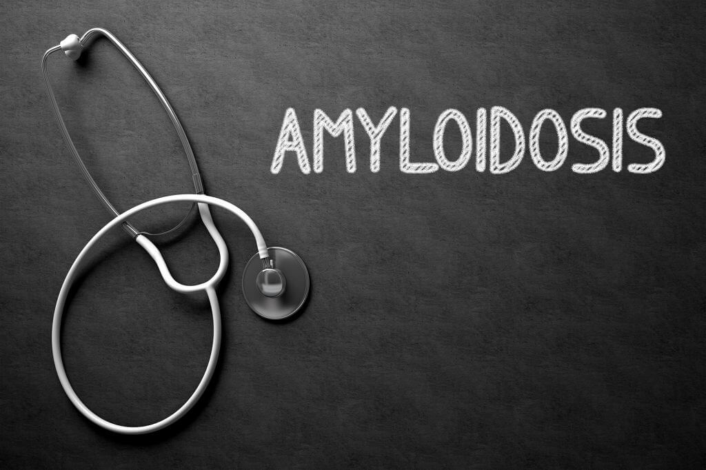 Amiloidosis