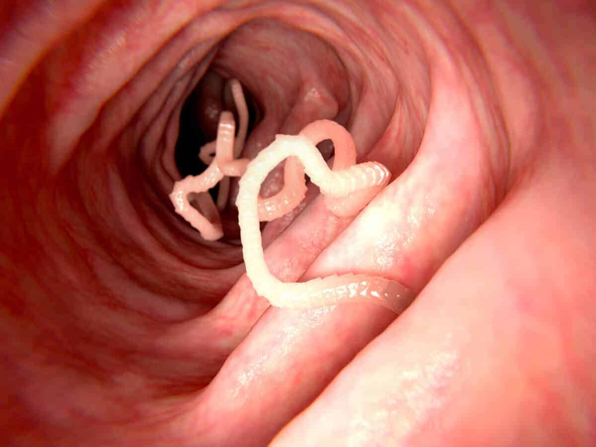 tapeworm infection